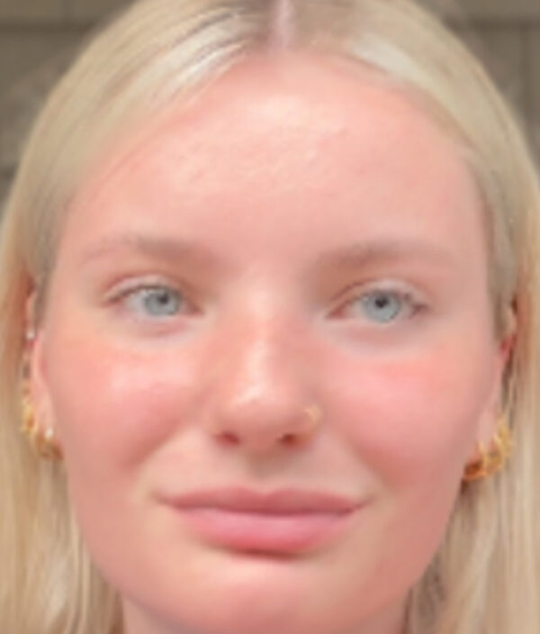 Emma after tallow - 3